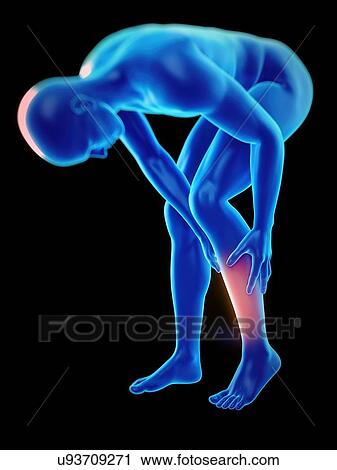 Person with leg ache, illustration. View Large Photo Image Stock Image - Person with leg ache, illustration.. Fotosearch