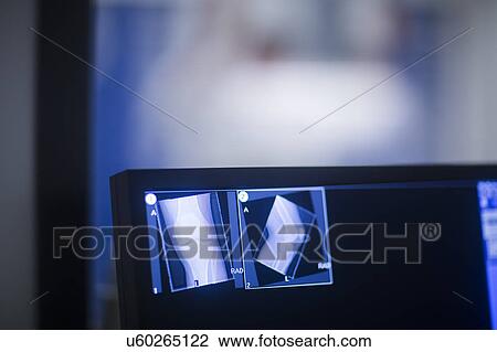 Screen in radiology department View Large Photo Image Stock Image - Screen in radiology department. Fotosearch