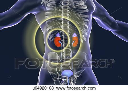 Treatment of kidney disease, illustration View Large Photo Image Stock Photo - Treatment of kidney disease, illustration. Fotosearch