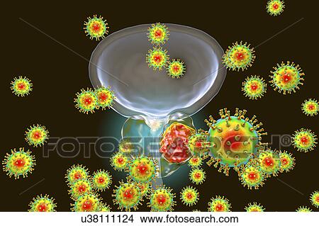 Picture - Viral etiology of prostate cancer. Conceptual illustration showing viruses infecting prostate gland and causing cancer development.. Fotosearch