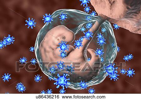 Stock Photograph - Viruses infecting human embryo, conceptual illustration. The embryo is 4 weeks old. Many viruses cause fetal abnormalities or stillbirth. For example, rubella, herpes and cytomegalovirus cause different fetal pathology, whilst fetal measles infection.... Fotosearch