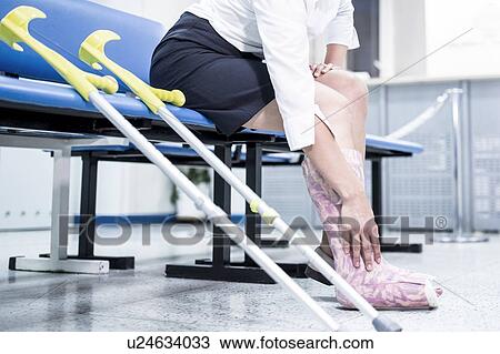 Stock Image - Woman with leg in plaster sitting on chair with crutches.. Fotosearch