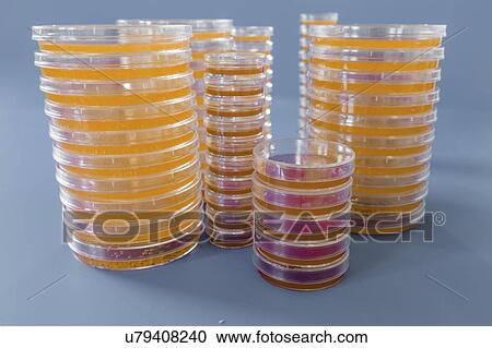 Agar plates. Stacks of Petri dishes with cultured agar. View Large Photo Image Stock Image - Agar plates. Stacks of Petri dishes with cultured agar.. Fotosearch