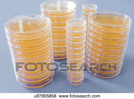 Stock Photo - Agar plates. Stacks of Petri dishes with cultured agar.. Fotosearch