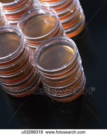 Stock Photo - Agar plates.. Fotosearch