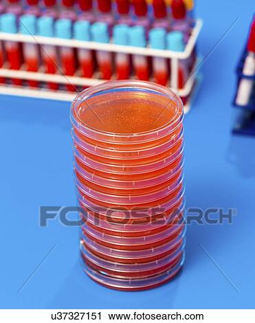 Stock Image - Biological samples in a lab.. Fotosearch