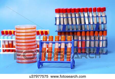 Biological samples in a lab. View Large Photo Image Stock Photography - Biological samples in a lab.. Fotosearch