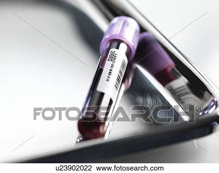 Blood sample awaiting analysis. View Large Photo Image Stock Image - Blood sample awaiting analysis.. Fotosearch