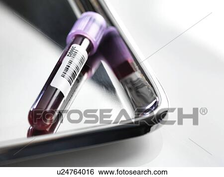 Stock Photograph - Blood sample awaiting analysis.. Fotosearch