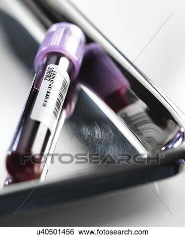 Stock Photograph - Blood sample awaiting analysis.. Fotosearch