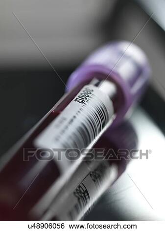 Blood sample awaiting analysis. View Large Photo Image Stock Photograph - Blood sample awaiting analysis.. Fotosearch