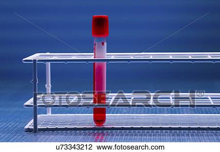 Stock Image - Blood sample.. Fotosearch