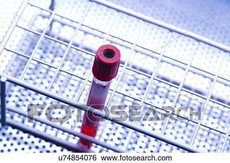 Stock Photograph - Blood sample.. Fotosearch