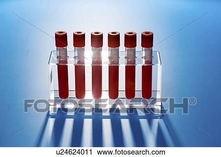 Blood samples in a lab. View Large Photo Image Stock Image - Blood samples in a lab.. Fotosearch
