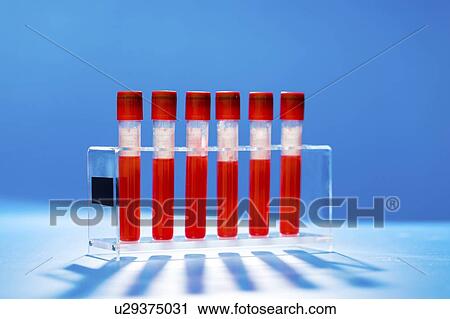 Blood samples in a lab. View Large Photo Image Stock Image - Blood samples in a lab.. Fotosearch