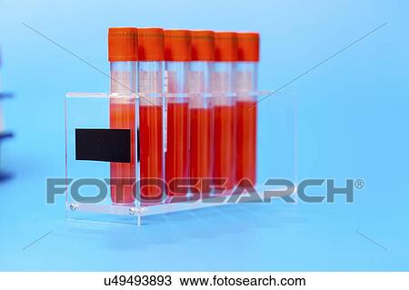 Stock Image - Blood samples in a lab.. Fotosearch