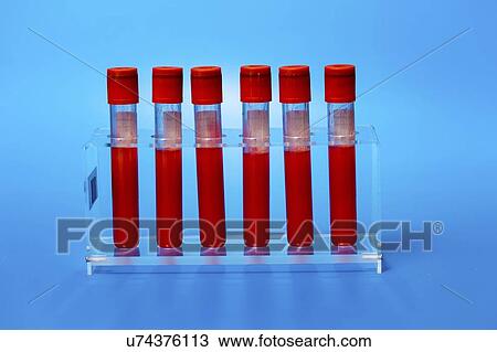 Stock Image - Blood samples in a lab.. Fotosearch
