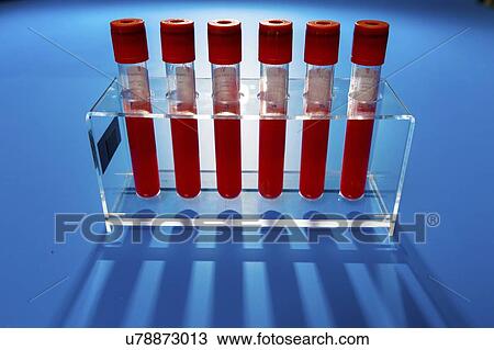 Blood samples in a lab. View Large Photo Image Stock Image - Blood samples in a lab.. Fotosearch