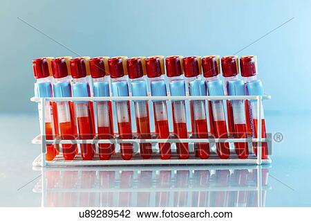 Blood samples in a lab. View Large Photo Image Stock Image - Blood samples in a lab.. Fotosearch