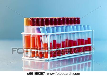 Blood samples in a lab. View Large Photo Image Stock Photo - Blood samples in a lab.. Fotosearch