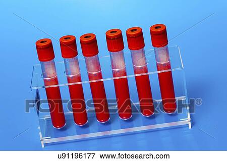Blood samples in a lab. View Large Photo Image Stock Photo - Blood samples in a lab.. Fotosearch