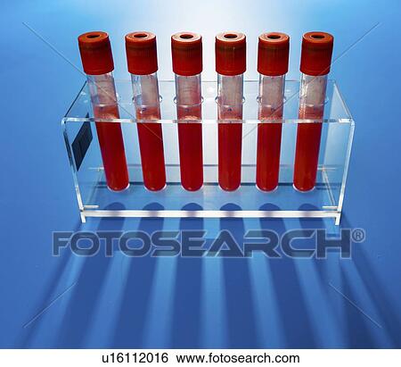 Stock Photograph - Blood samples in a lab.. Fotosearch