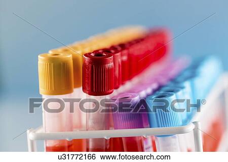 Blood samples in a lab. View Large Photo Image Stock Photograph - Blood samples in a lab.. Fotosearch