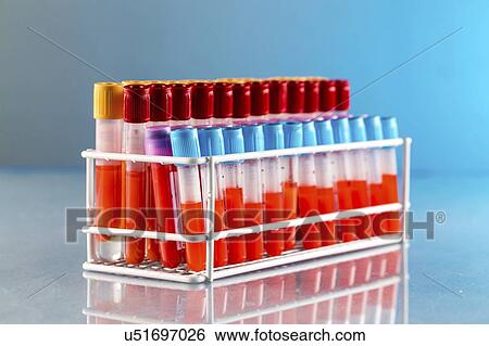 Blood samples in a lab. View Large Photo Image Stock Photograph - Blood samples in a lab.. Fotosearch