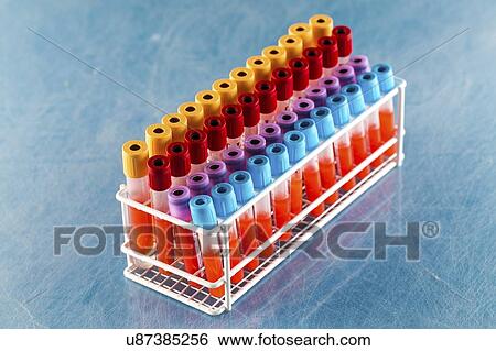 Blood samples in a lab. View Large Photo Image Stock Photograph - Blood samples in a lab.. Fotosearch