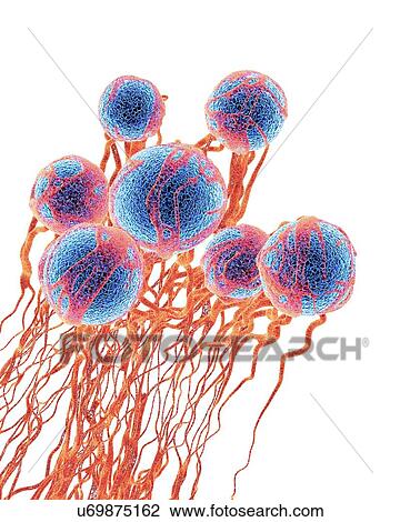 Stock Image - Cancer cells. Computer illustration of cancer cells, showing the blood vessel formation providing the cells with oxygens and nutrients. The cells with their nuclei are shown in blue.. Fotosearch