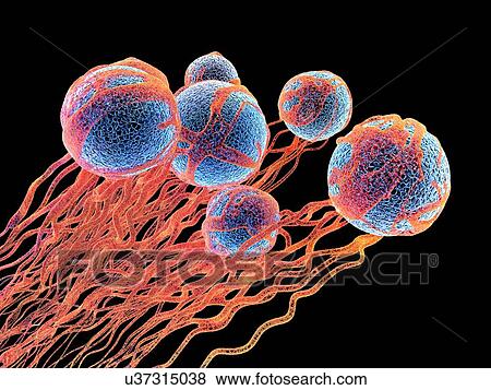 Stock Photo - Cancer cells. Computer illustration of cancer cells, showing the blood vessel formation providing the cells with oxygens and nutrients. The cells with their nuclei are shown in blue.. Fotosearch