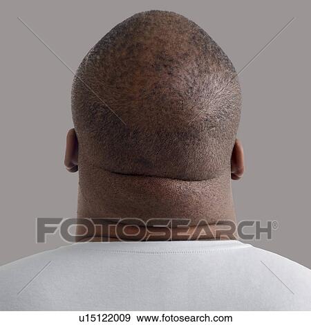 Stock Photo - Close up of overweight man's neck, rear view.. Fotosearch