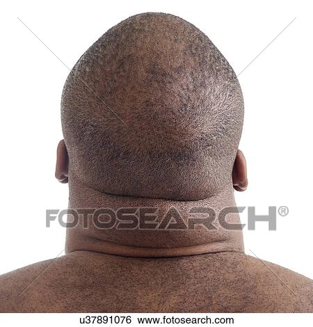 Close up of overweight man's neck, rear view. View Large Photo Image Stock Photograph - Close up of overweight man's neck, rear view.. Fotosearch