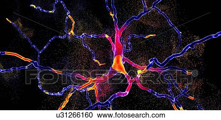 Stock Image - Conceptual illustration of the degeneration of a dopaminergic neuron, the key step in development of Parkinson's disease.. Fotosearch