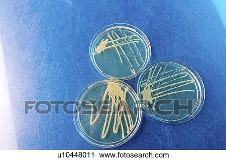 Stock Image - Cultures growing on Petri dish.. Fotosearch