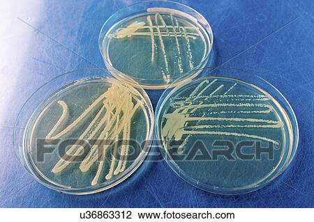 Cultures growing on Petri dish. View Large Photo Image Stock Image - Cultures growing on Petri dish.. Fotosearch