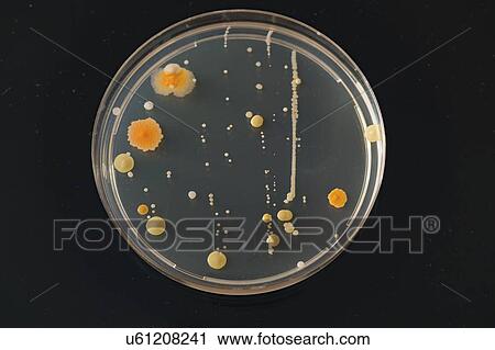 Stock Image - Cultures growing on Petri dish.. Fotosearch