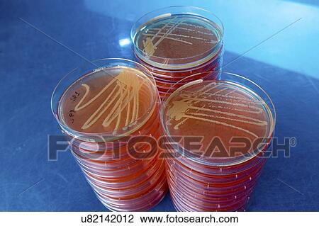 Cultures growing on Petri dish. View Large Photo Image Stock Image - Cultures growing on Petri dish.. Fotosearch