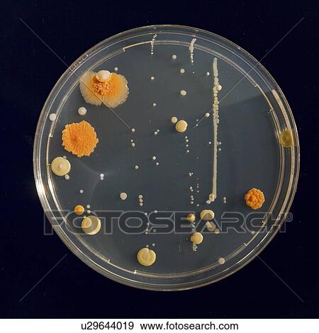 Stock Photo - Cultures growing on Petri dish.. Fotosearch