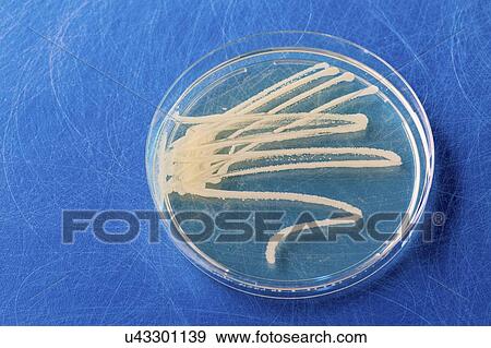Cultures growing on Petri dish. View Large Photo Image Stock Photo - Cultures growing on Petri dish.. Fotosearch