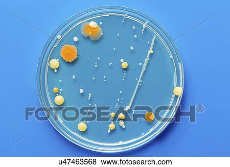 Stock Photo - Cultures growing on Petri dish.. Fotosearch