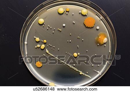 Cultures growing on Petri dish. View Large Photo Image Stock Photo - Cultures growing on Petri dish.. Fotosearch