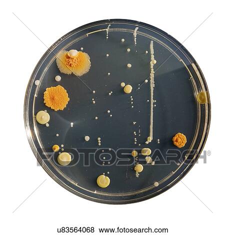 Stock Photo - Cultures growing on Petri dish.. Fotosearch