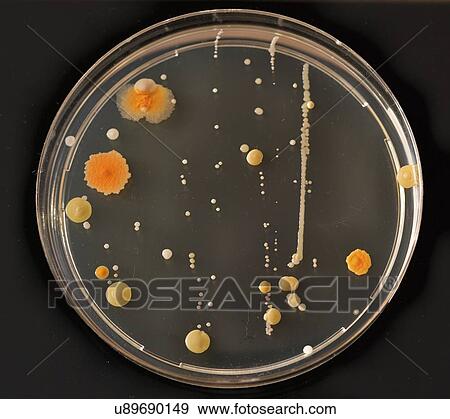 Stock Photo - Cultures growing on Petri dish.. Fotosearch