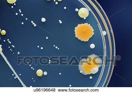 Stock Photo - Cultures growing on Petri dish.. Fotosearch