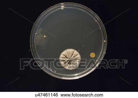 Cultures growing on Petri dish. View Large Photo Image Stock Photograph - Cultures growing on Petri dish.. Fotosearch