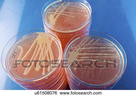 Cultures growing on Petri dish. View Large Photo Image Stock Photograph - Cultures growing on Petri dish.. Fotosearch