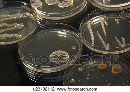 Stock Image - Cultures growing on Petri dishes.. Fotosearch