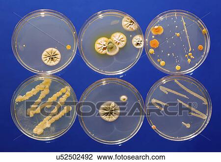 Stock Image - Cultures growing on Petri dishes.. Fotosearch