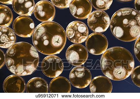Cultures growing on Petri dishes. View Large Photo Image Stock Image - Cultures growing on Petri dishes.. Fotosearch